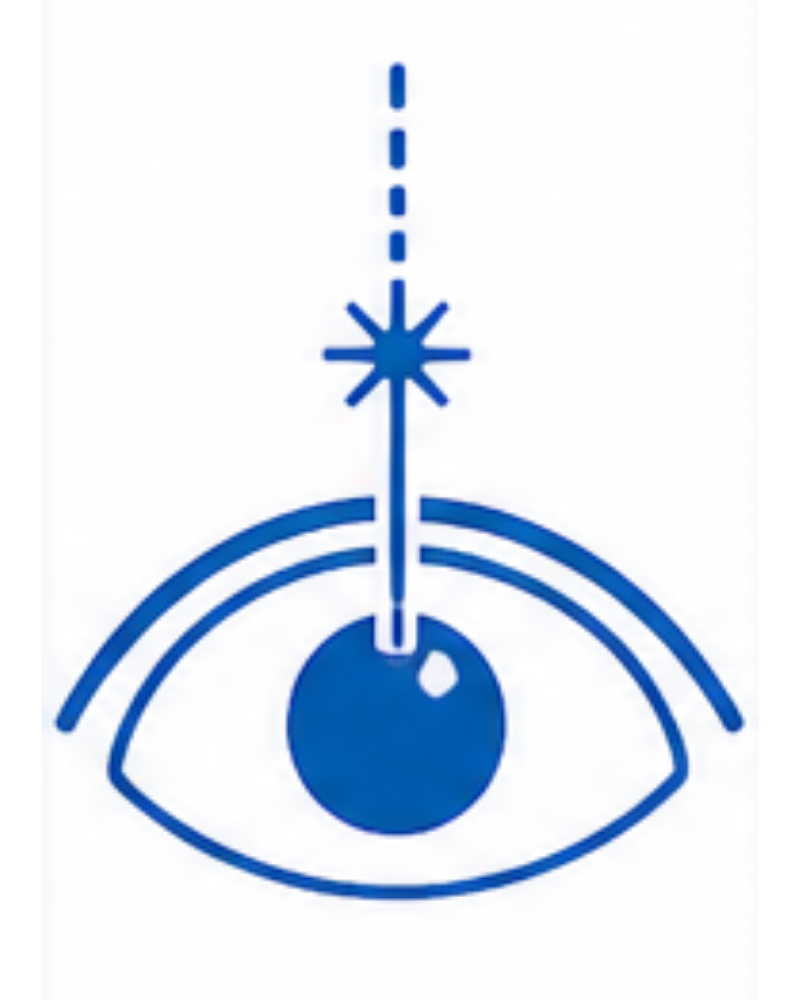 LASIK and Refractive Surgery