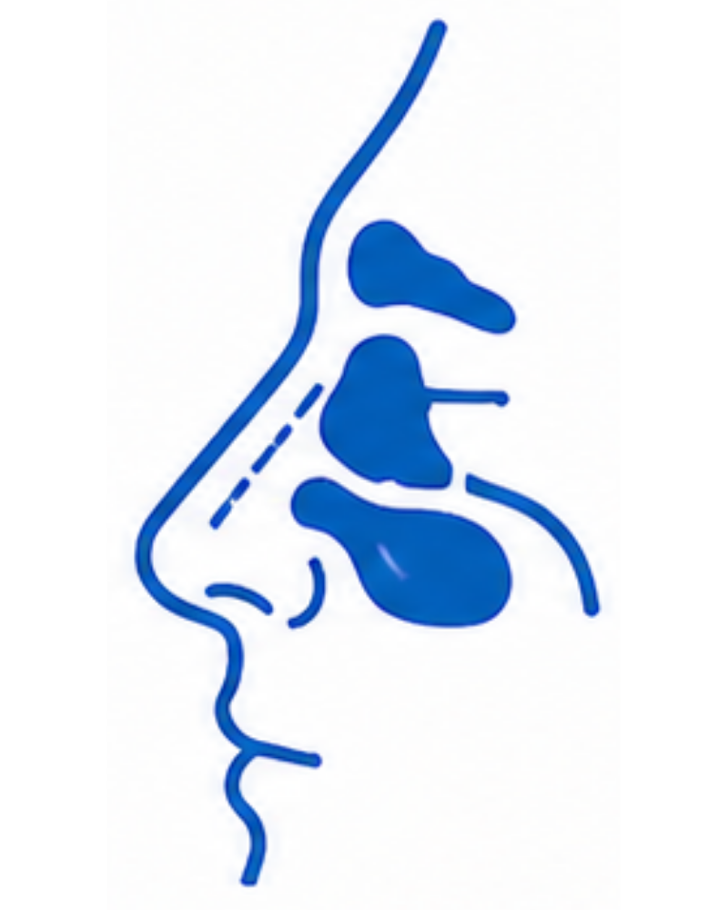 Sinus Surgery