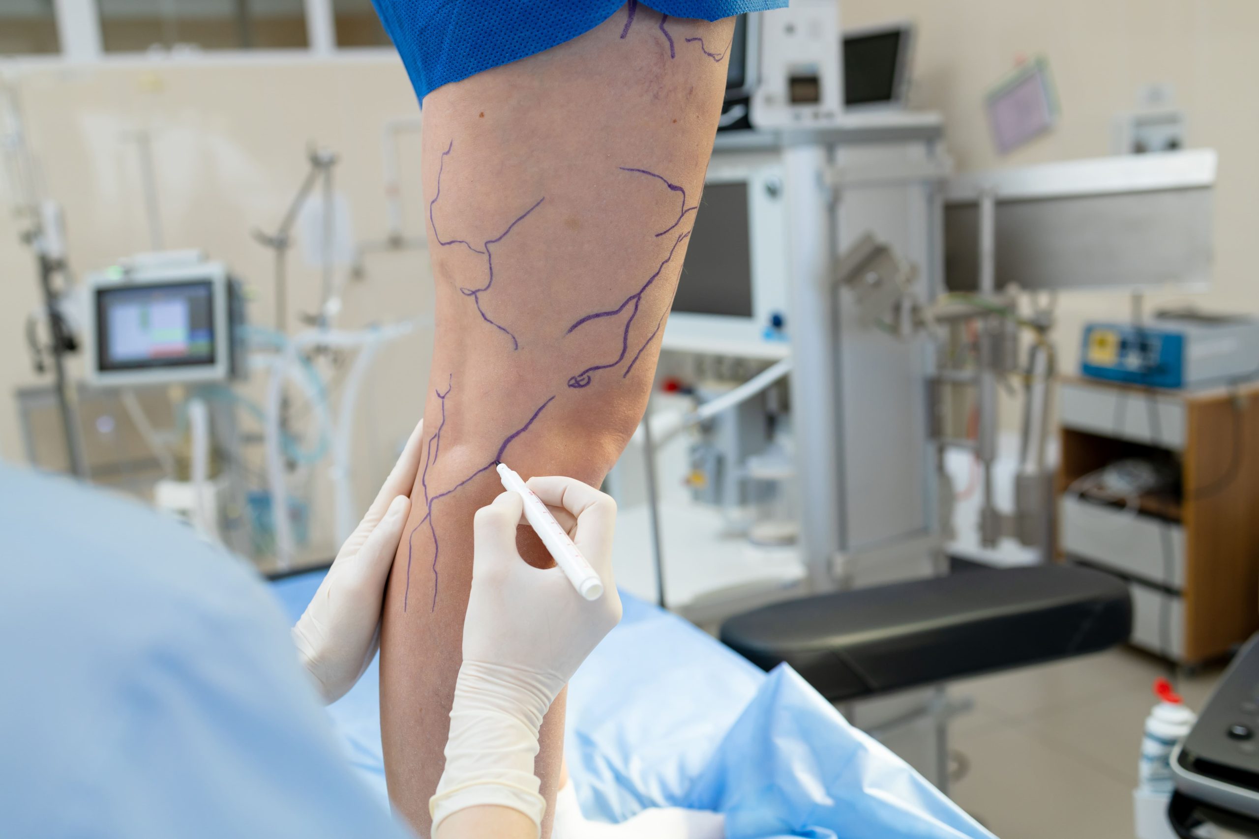 vascular surgery