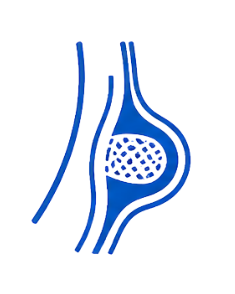 Hernia Repair Surgery