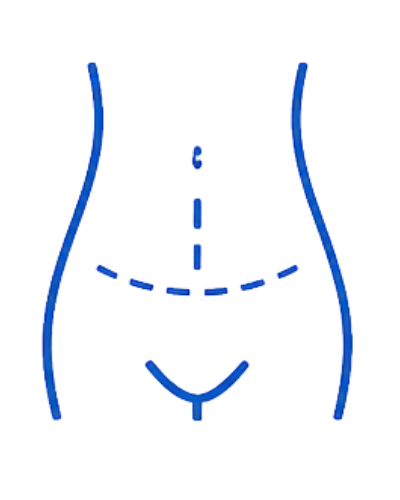 Minor & Major Abdominal Surgeries