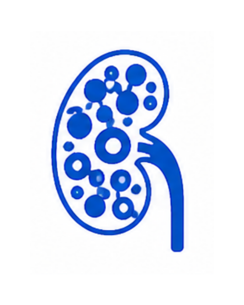 Polycystic Kidney Disease Management