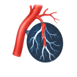 Angiography_N