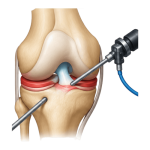 Arthroscopy