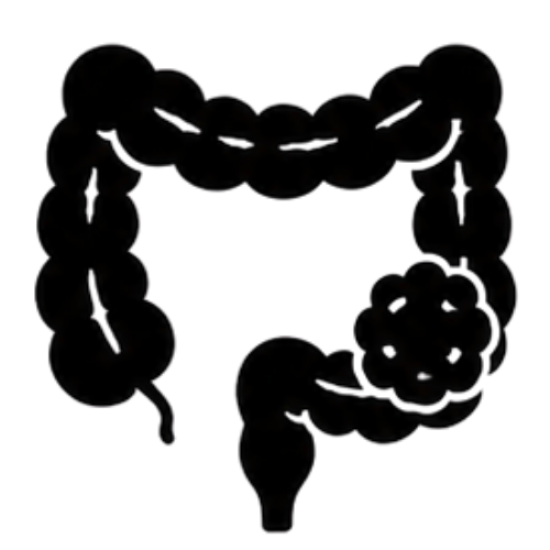 Colorectal Cancer