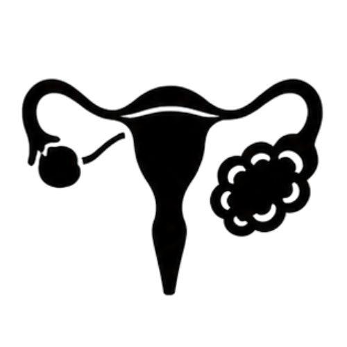 Ovarian Cancer