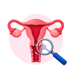 Pap Smear Screening