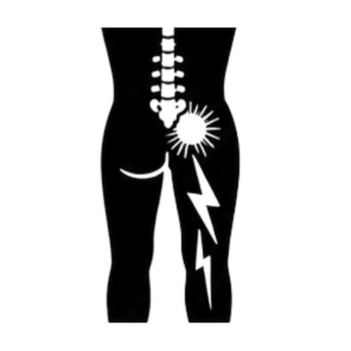 Sciatica