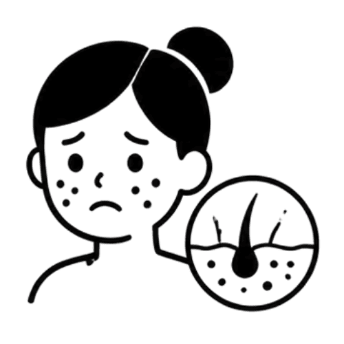 Skin Conditions