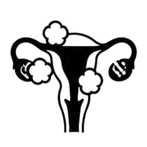Uterine Fibroids