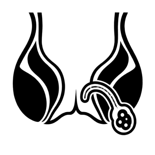 Anal Fistula