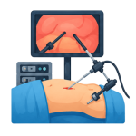 Laparoscopic Surgery