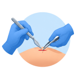 Minor Procedures