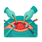 Open Surgery